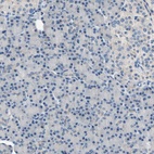 Anti-RASD2 Antibody
