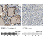 Anti-EIF2B2 Antibody