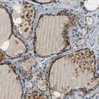 Immunohistochemical staining of human thyroid gland shows high expression.