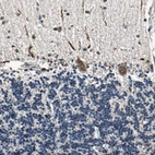 Immunohistochemical staining of human cerebellum shows moderate cytoplasmic positivity in Purkinje cells.