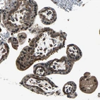 Immunohistochemical staining of human placenta shows moderate cytoplasmic positivity in trophoblastic cells.