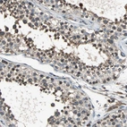Immunohistochemical staining of human testis shows moderate cytoplasmic positivity in cells in seminiferous ducts.