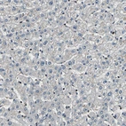 Immunohistochemical staining of human liver shows no positivity in hepatocytes as expected.