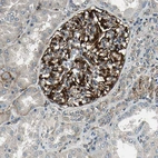 Immunohistochemical staining of human kidney shows strong cytoplasmic positivity in cells in glomeruli.