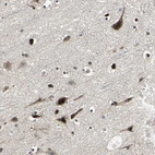 Immunohistochemical staining of human cerebral cortex shows strong cytoplasmic positivity in neurons.