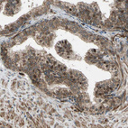 Anti-EXD2 Antibody