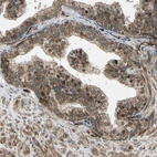Immunohistochemical staining of human prostate shows moderate to strong cytoplasmic positivity in glandular cells.