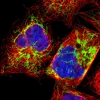 Immunofluorescent staining of human cell line A-431 shows localization to mitochondria.