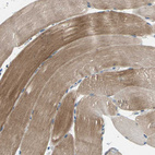 Immunohistochemical staining of human skeletal muscle shows weak to moderate cytoplasmic positivity in myocytes.