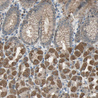 Anti-TRAK1 Antibody