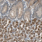 Immunohistochemical staining of human stomach shows moderate cytoplasmic positivity in glandular cells.