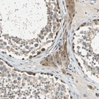 Immunohistochemical staining of human testis shows weak to moderate cytoplasmic positivity in Leydig cells and cells in seminiferous ducts.