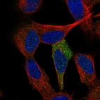 Anti-TP53INP1 Antibody