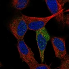 Immunofluorescent staining of human cell line SH-SY5Y shows localization to cytosol.