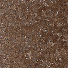 Immunohistochemical staining of human liver shows moderate to strong cytoplasmic positivity in hepatocytes.