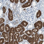 Immunohistochemical staining of human kidney shows moderate to strong cytoplasmic positivity in cells in tubules.