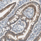 Immunohistochemical staining of human duodenum shows moderate cytoplasmic positivity in glandular cells.