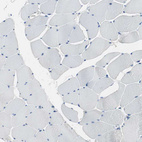Immunohistochemical staining of human skeletal muscle shows no positivity in myocytes as expected.
