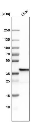 Anti-FBP1 Antibody