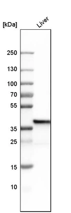 Western blot analysis in human liver tissue.