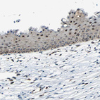Immunohistochemical staining of human cervix, uterine shows strong nuclear positivity in squamous epithelial cells.