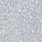 Immunohistochemical staining of human liver shows no positivity in hepatocytes as expected.