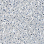 Immunohistochemical staining of human liver shows no positivity in hepatocytes as expected.