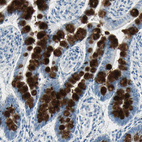 Anti-MUC4 Antibody