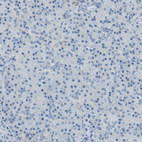 Immunohistochemical staining of human pancreas shows no cytoplasmic positivity in exocrine glandular cells as expected.
