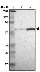 Lane 1: Marker [kDa] 220, 112, 84, 47, 32, 26, 17_br/_Lane 2: Human cell line RT-4_br/_Lane 3: Human cell line U-251MG sp