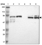 Lane 1: Marker [kDa] 220, 112, 84, 47, 32, 26, 17_br/_Lane 2: Human cell line RT-4_br/_Lane 3: Human cell line U-251MG sp_br/_Lane 4: Human plasma (IgG/HSA depleted)_br/_Lane 5: Human liver tissue_br/_Lane 6: Human tonsil tissue