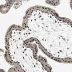 Immunohistochemical staining of human placenta shows moderate nuclear positivity in trophoblastic cells.