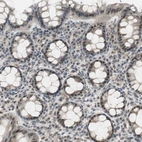 Immunohistochemical staining of human rectum shows moderate nuclear positivity in glandular cells.