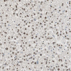 Immunohistochemical staining of human liver shows moderate to strong nuclear positivity in hepatocytes.