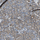 Anti-SLC16A7 Antibody