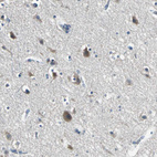 Anti-SLC16A7 Antibody