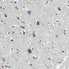 Immunohistochemical staining of human cerebral cortex shows moderate cytoplasmic positivity in neurons.