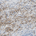 Anti-SLC16A7 Antibody