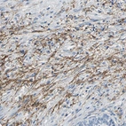 Immunohistochemical staining of human prostate shows strong cytoplasmic positivity in smooth muscle cells.
