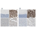 Immunohistochemical staining of human cerebellum, heart muscle, liver and skeletal muscle using Anti-FHL2 antibody HPA005922 (A) shows similar protein distribution across tissues to independent antibody HPA006028 (B).