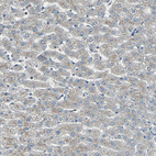 Anti-FHL2 Antibody