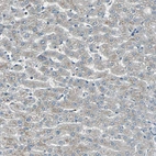 Immunohistochemical staining of human liver shows low positivity in hepatocytes as expected.