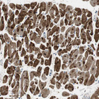 Anti-FHL2 Antibody