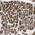 Immunohistochemical staining of human heart muscle shows strong cytoplasmic and nuclear positivity in cardiomyocytes.