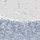 Anti-FHL2 Antibody