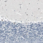 Immunohistochemical staining of human cerebellum shows low positivity as expected.