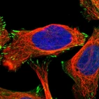 Immunofluorescent staining of human cell line U-2 OS shows localization to actin filaments & focal adhesion sites.