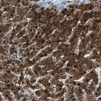 Anti-FAM65A Antibody