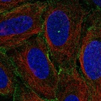 Anti-MYO1C Antibody