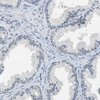 Immunohistochemical staining of human prostate shows negative membranous positivity in glandular cells as expected.